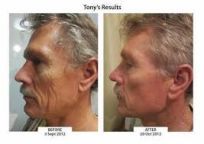 mens skin care, anti ageing, skin care, metro , no more wrinkles,