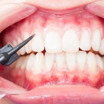 teeth cleaning - Chicago, IL - Dr. Mary A. Starsiak teeth cleaning - Chicago, IL - Dr. Mary A. Starsiak