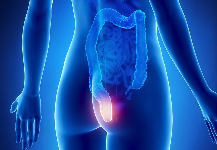 Hemorrhoid Symptoms