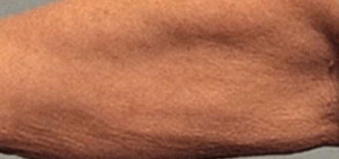 Eine Nahaufnahme des Arms einer Person vor grauem Hintergrund.