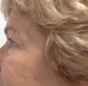 Eine Nahaufnahme des Gesichts einer Frau mit blondem Haar.