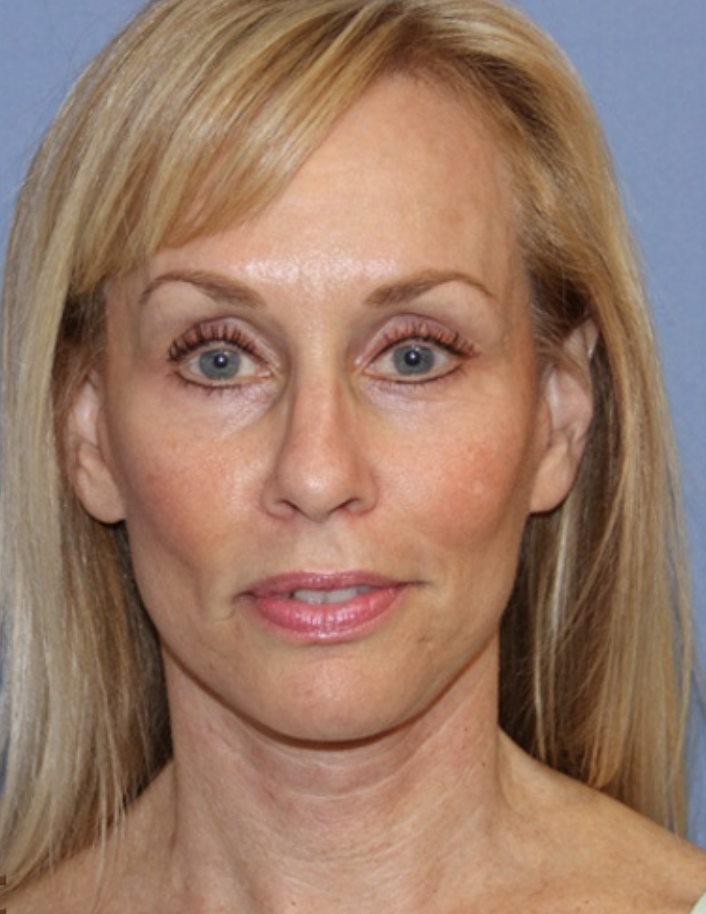 Eine Frau mit blonden Haaren und blauen Augen schaut in die Kamera