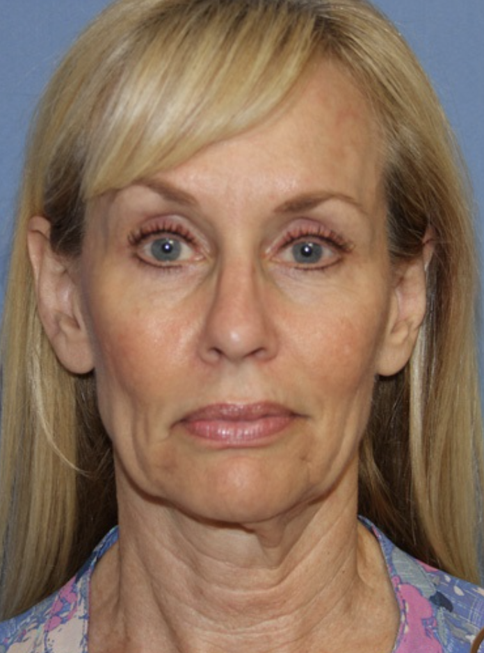Eine Frau mit blonden Haaren und blauen Augen schaut in die Kamera.