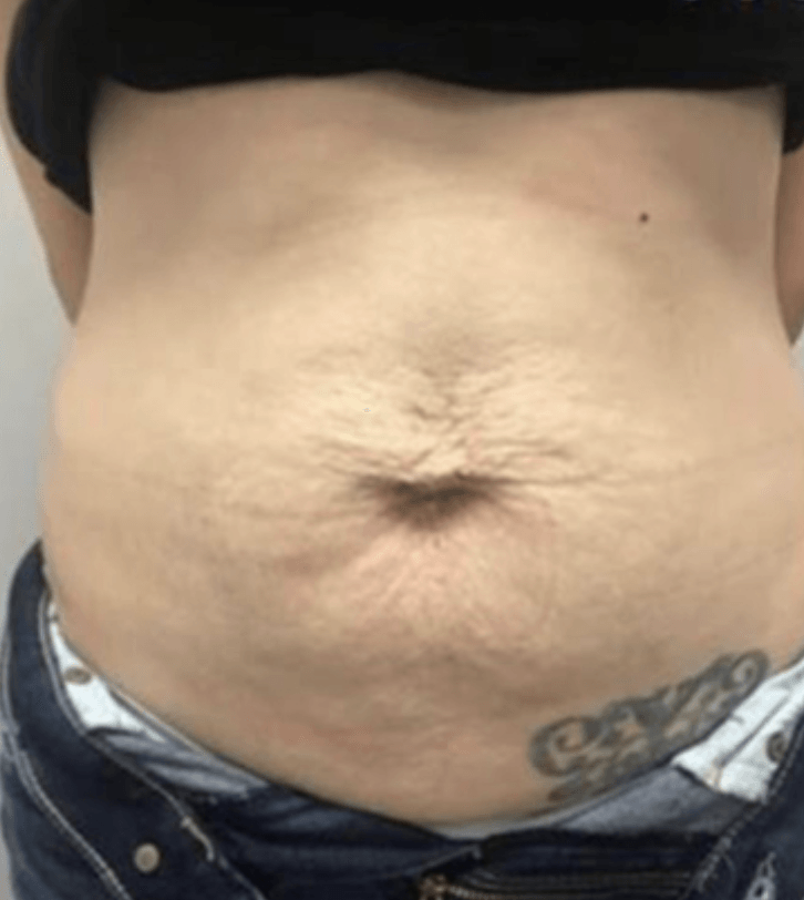 Eine Nahaufnahme vom Bauch einer Frau mit einer Tätowierung darauf.
