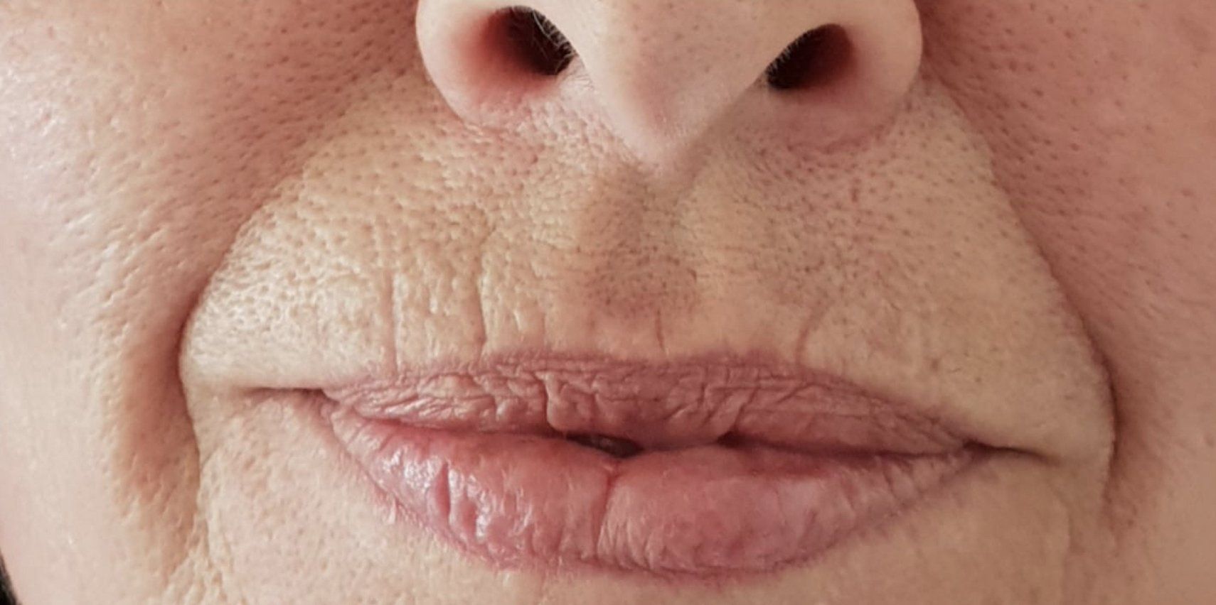 Nahaufnahme von Nase und Mund einer Person mit neutralen Lippen und leichtem Gesichtshaarschatten