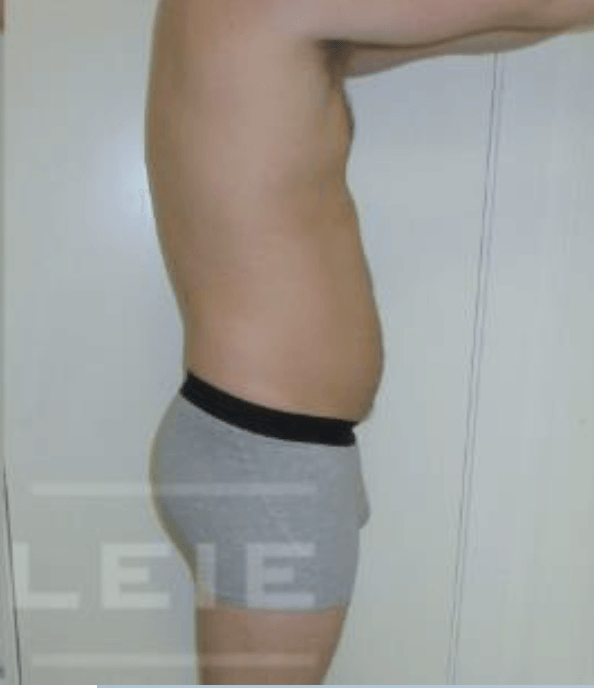 Seitenansicht einer Person, die in einem Innenraum steht und graue Shorts mit schwarzem Bund trägt.