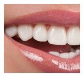 dental crown Laurel