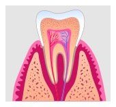 root canal in Laurel