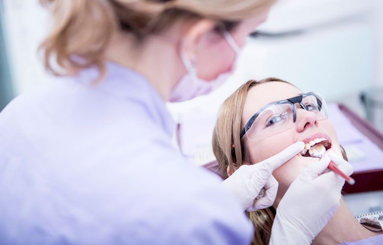 Dental Fillings & Restorations