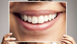 Cosmetic Dentistry woman holding a photo of dental veneers over her face