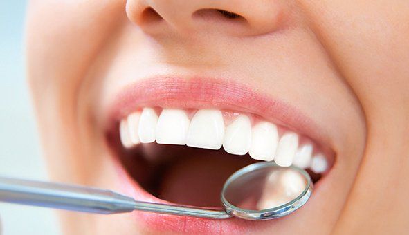 Dental Fillings