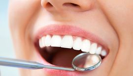Dental Fillings Dental Fillings