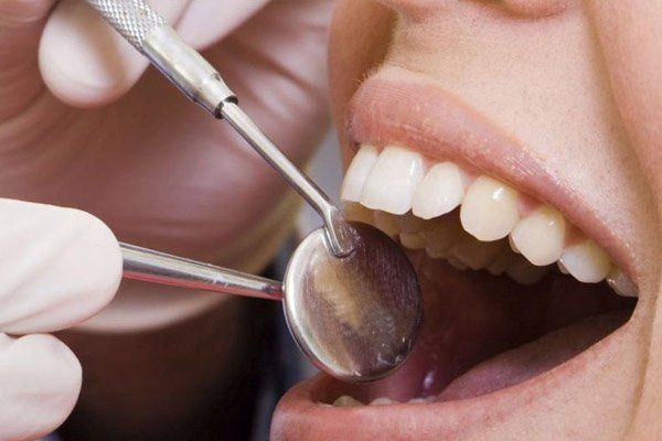 mandurah dental dentist checking inside mouth