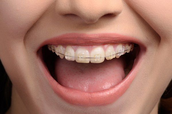 dentist looking with a mirror inside a womans mouth