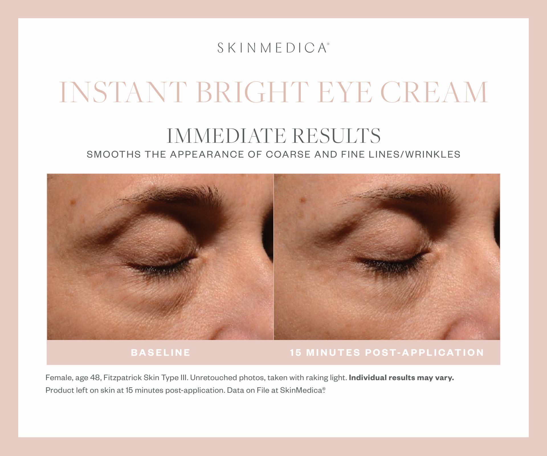 A before and after photo of a woman 's eye with instant bright eye cream.