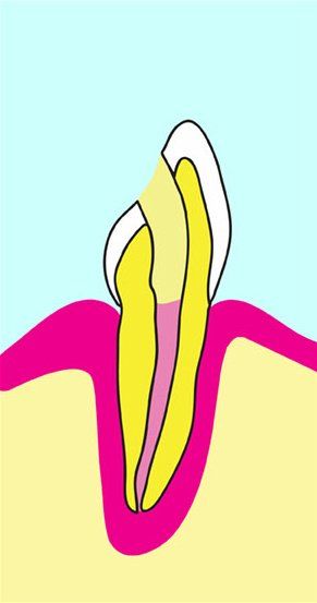 Tooth diagram: cross-section showing tooth structure, including enamel, dentin, pulp, and root.