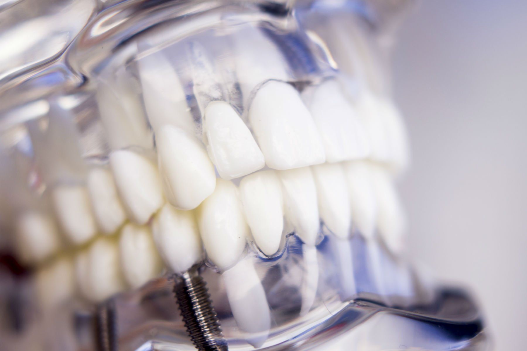 Denti