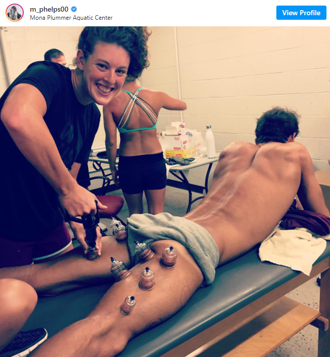 A man is getting acupuncture on his legs while a woman looks on.