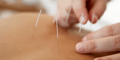 Chiropractor