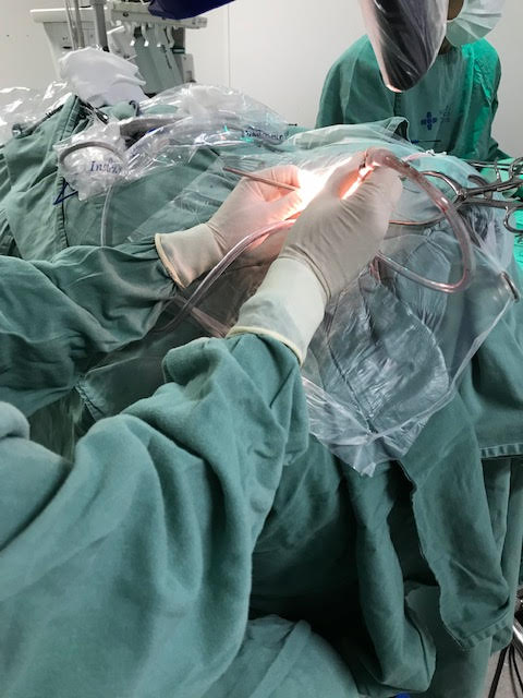 Cirurgia de Timpanoplastia Qual o valor de uma cirurgia de timpanoplastia