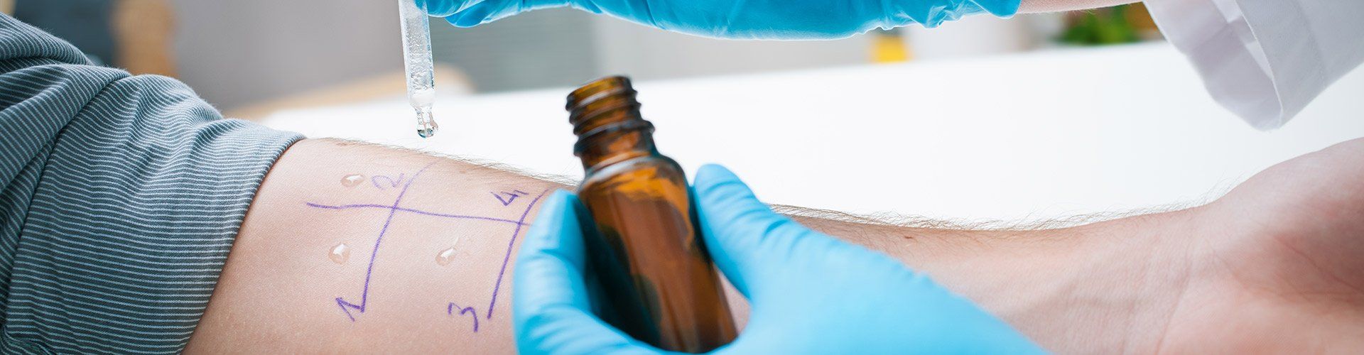 A person getting allergy testing near Irving, TX