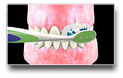 Oral Hygiene Instructions