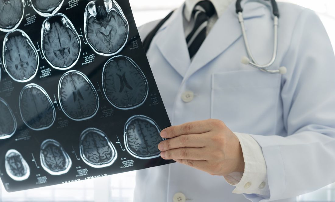 consulenza neurologica