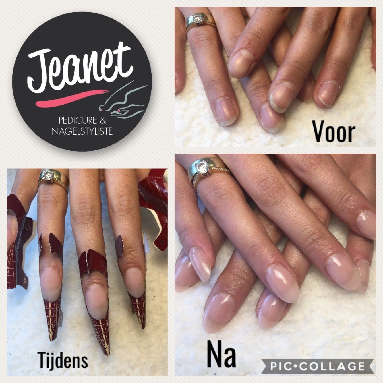 Nagelcollage met foto's van beschadigde nagels voor, tijdens en na een manicure door Jeanet.