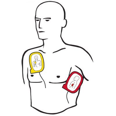www.CprBlsPros.com AED RENTAL