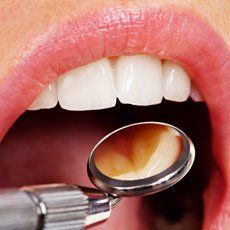 Professional dentistry