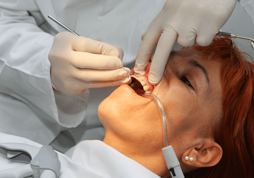 Dentist at work - Periodontics in Hemet, CA Dentist at work - Periodontics in Hemet, CA