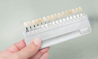 Check Veneer of Tooth Crown — Cosmetic Dentistry in Hemet, CA Check Veneer of Tooth Crown — Cosmetic Dentistry in Hemet, CA