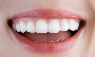 Close-up of Nice White Teeth — Cosmetic Dentistry in Hemet, CA Close-up of Nice White Teeth — Cosmetic Dentistry in Hemet, CA
