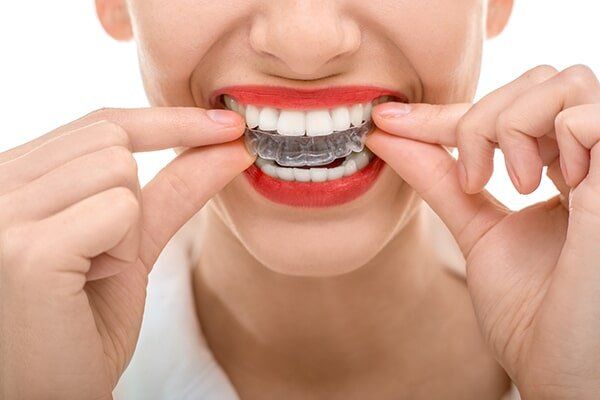 Wearing Orthodontic Silicone Trainer - Cosmetic Dentistry in Hemet, CA Wearing Orthodontic Silicone Trainer - Cosmetic Dentistry in Hemet, CA