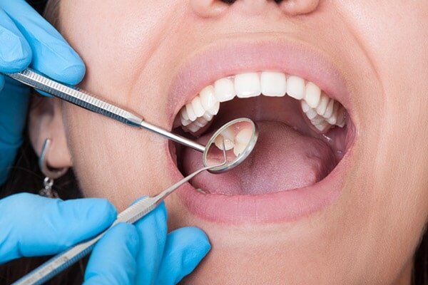 Tooth Check Up - Cosmetic Dentistry in Hemet, CA Tooth Check Up - Cosmetic Dentistry in Hemet, CA