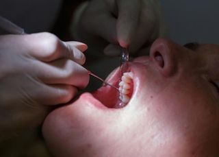 Patient at dental hygienists office - Periodontics in Hemet, CA Patient at dental hygienists office - Periodontics in Hemet, CA