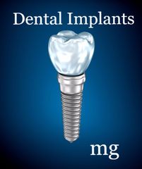 Dental Implants in Bristol with Dr Mark Gillis Dental Implants in Bristol with Dr Mark Gillis