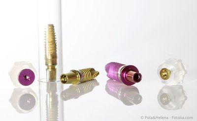 Was sind Zahnimplantate und woraus bestehen sie? Wie werden Implantate gesetzt? Was sind Zahnimplantate und woraus bestehen sie? Wie werden Implantate gesetzt?