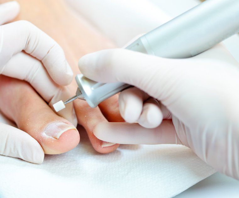 Een manicuretechnicus gebruikt een boor op de teennagels van een persoon, close-up.