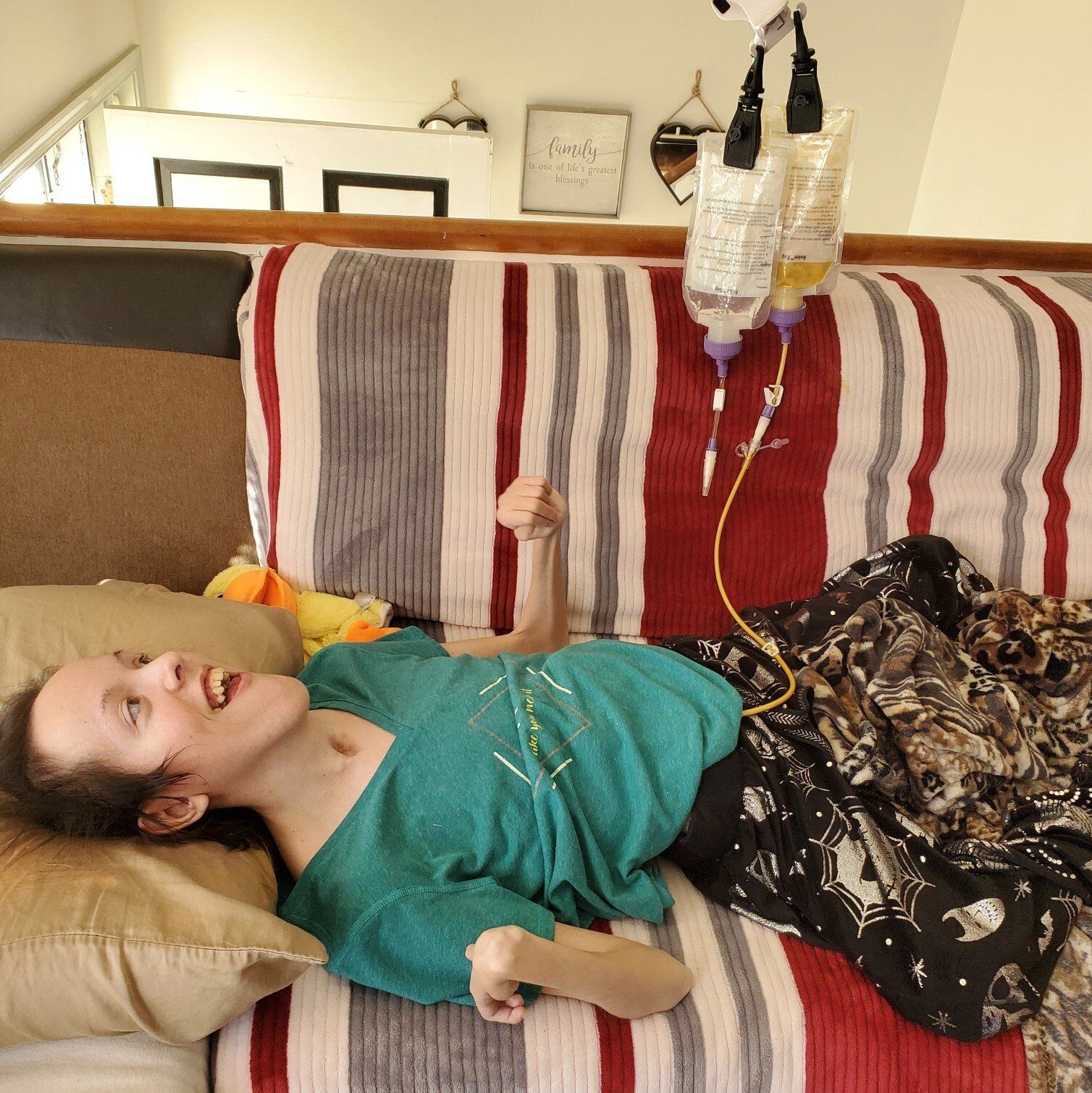 A person being tube fed using the Bolee Bag and Bolink Large Cap