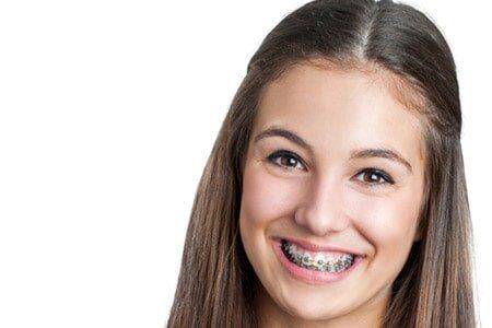 Braces — Local Family Dental Practice in Yorktown, VA
