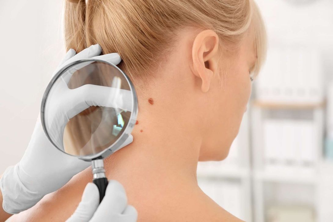 Laserterapia ginocchio
