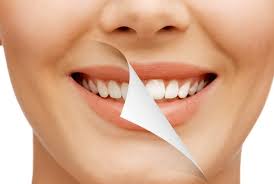 Smile Makeover, Saugus, MA
