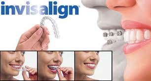 Invisalign, Saugus, MA