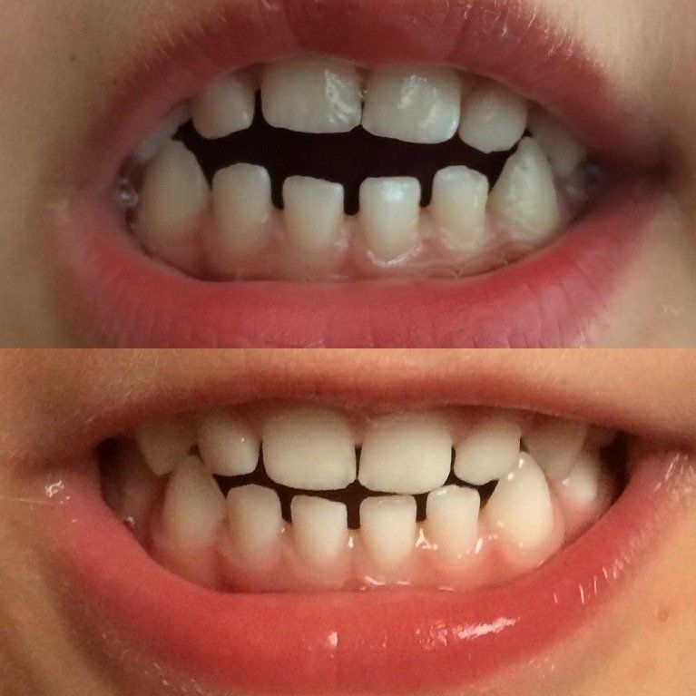 Tips en weetje over mondhygiëne door Saskia Den Hartog