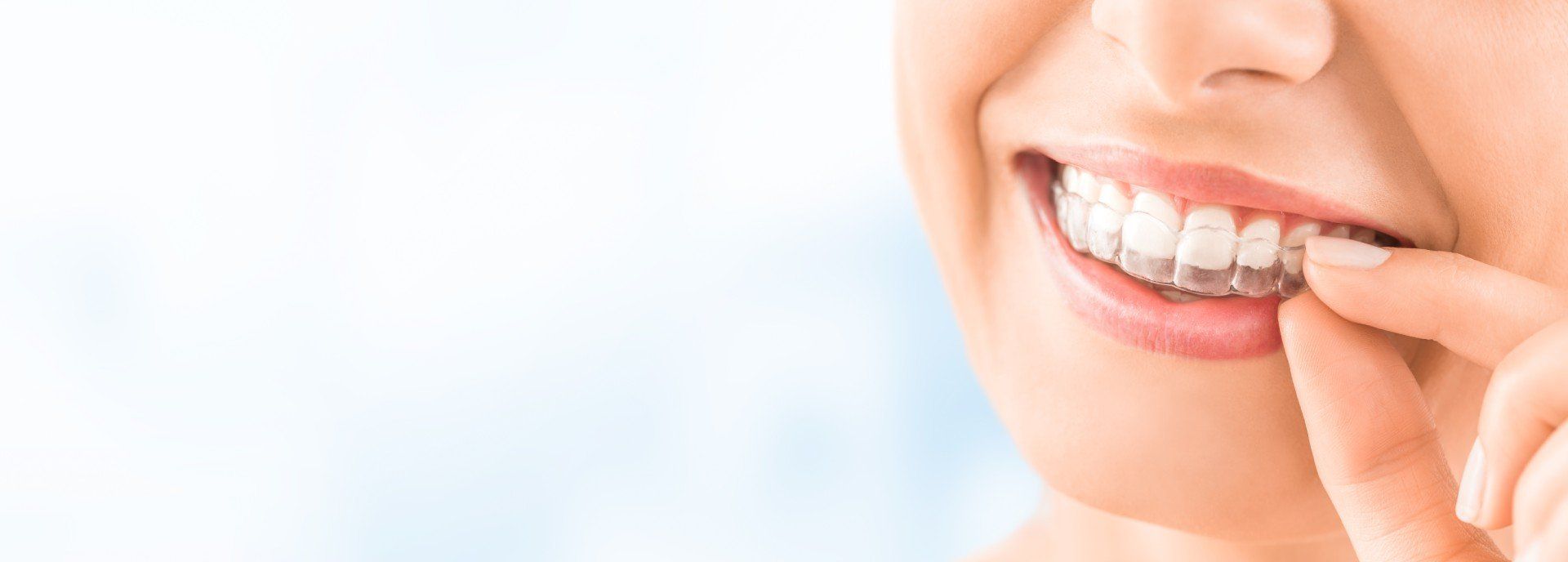 Woman inserting clear aligner in mouth, smiling, in front of light blue background.