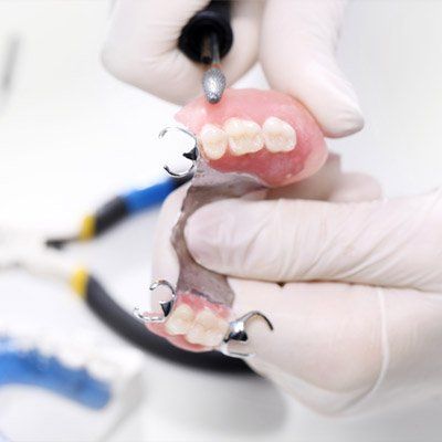 Woman Smile — Bleaching in Silver Spring, MD