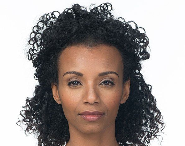 Injectables- after photo