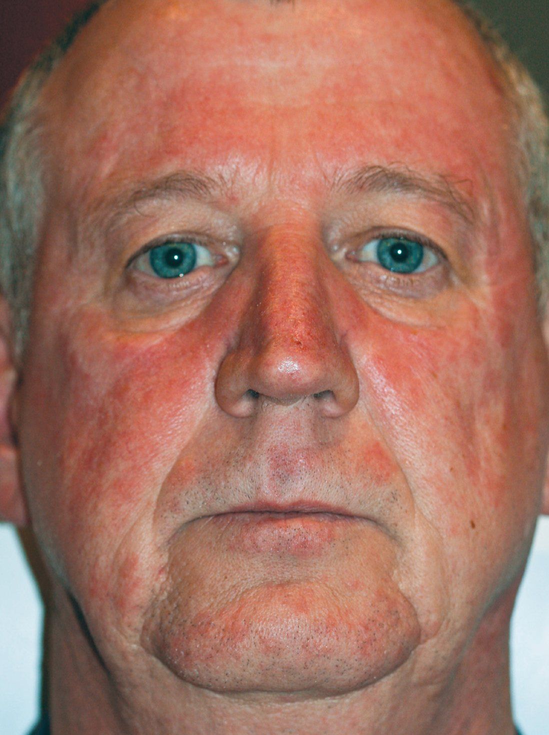 BBL Before Photo - A close up of a man's face