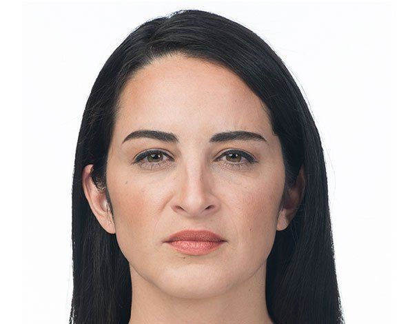 Injectables- after photo